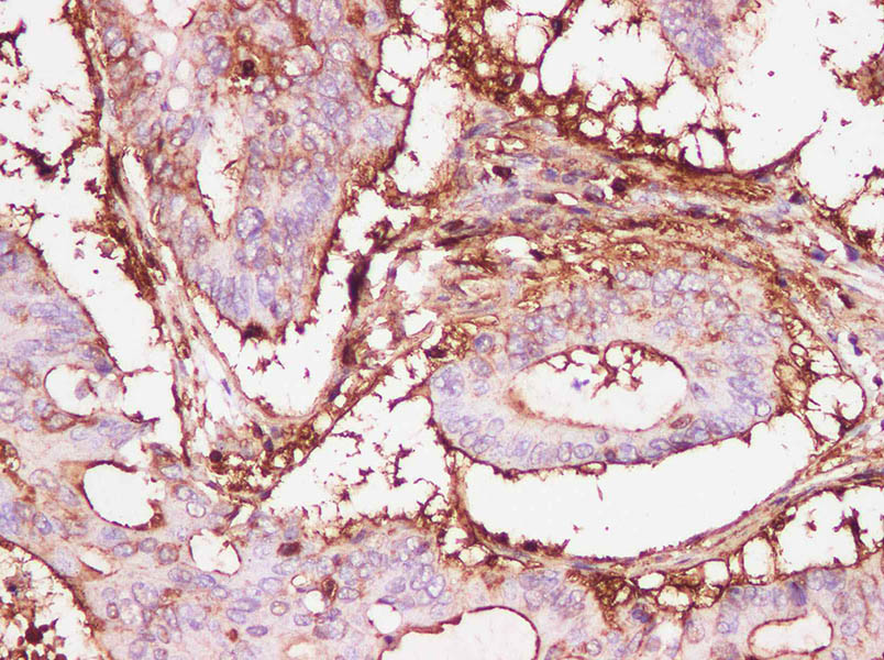 Purified Anti-Human IL-9 Antibody[MH9D1]-产品推荐-1