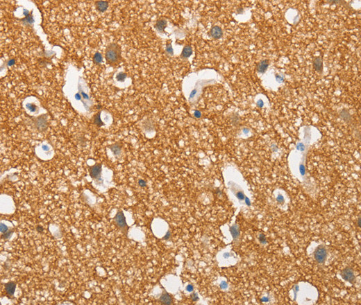 Immunohistochemistry of paraffin-embedded Human brain  tissue using SNCA Polyclonal Antibody at dilution 1:60