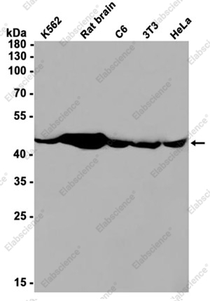 Recombinant Citrate Synthetase Monoclonal Antibody - 1