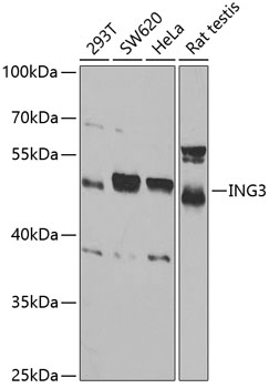 Western blot analysis of extracts of various cell lines using ING3 Polyclonal Antibody at 1:1000 dilution.