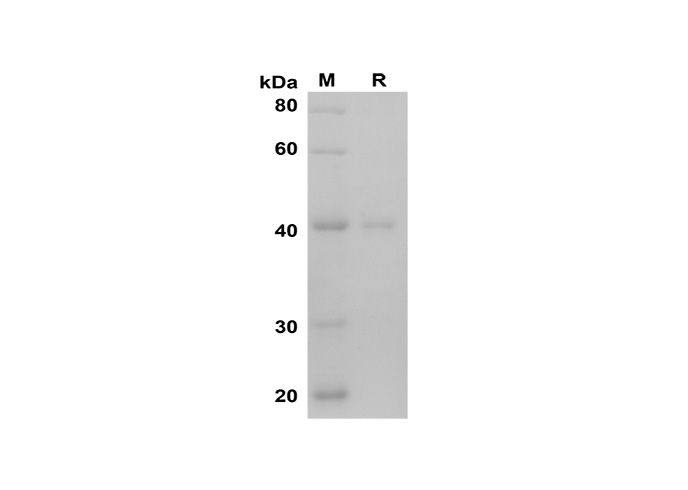 Recombinant Mouse IFN-γ Protein(GST Tag)-1