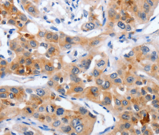 NCK1 Polyclonal Antibody - 2