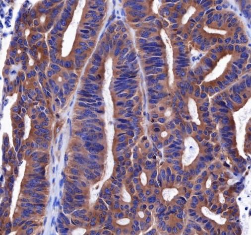Recombinant ROCK2+ROCK1 Monoclonal Antibody - small - 2
