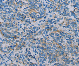 Claudin 4 Polyclonal Antibody - 2