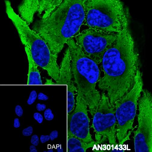 Recombinant alpha Actinin 4 Monoclonal Antibody - 3