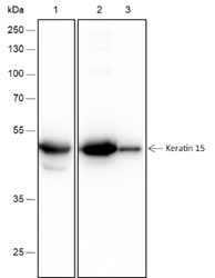 Recombinant Keratin 15 Monoclonal Antibody - 2
