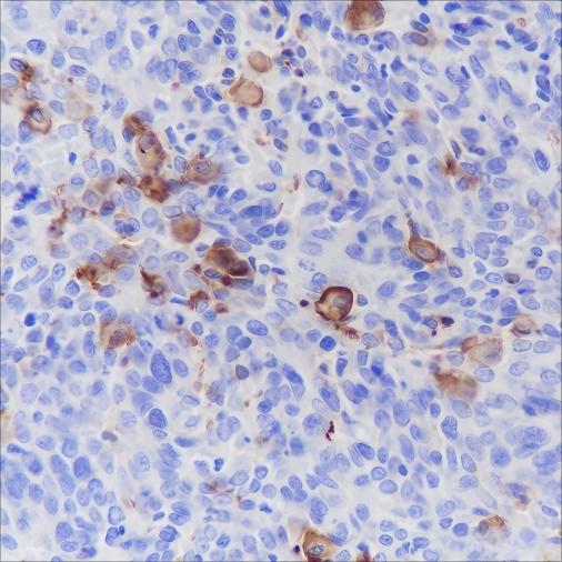 Recombinant CD16a Monoclonal Antibody - small - 4
