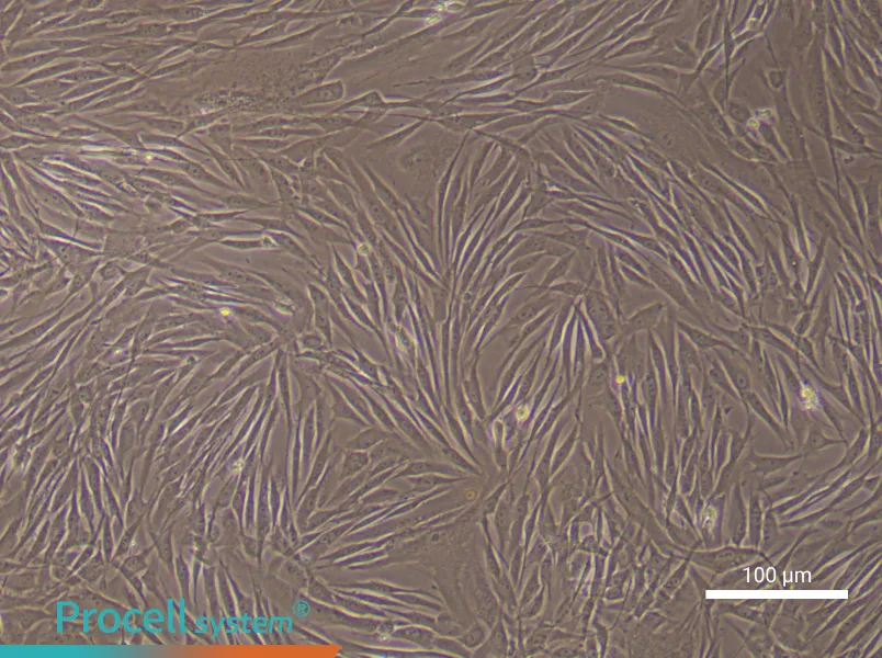 Human Pulmonary Artery Fibroblast Complete Medium - 3