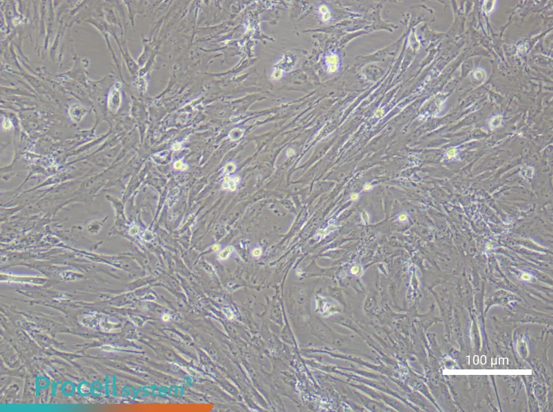 Mouse Gastric Smooth Muscle Cell Complete Medium - 3