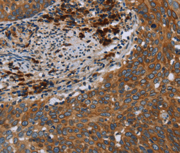 HYAL3 Polyclonal Antibody - 2