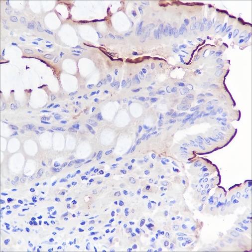 Recombinant CEACAM1 Monoclonal Antibody - small - 3