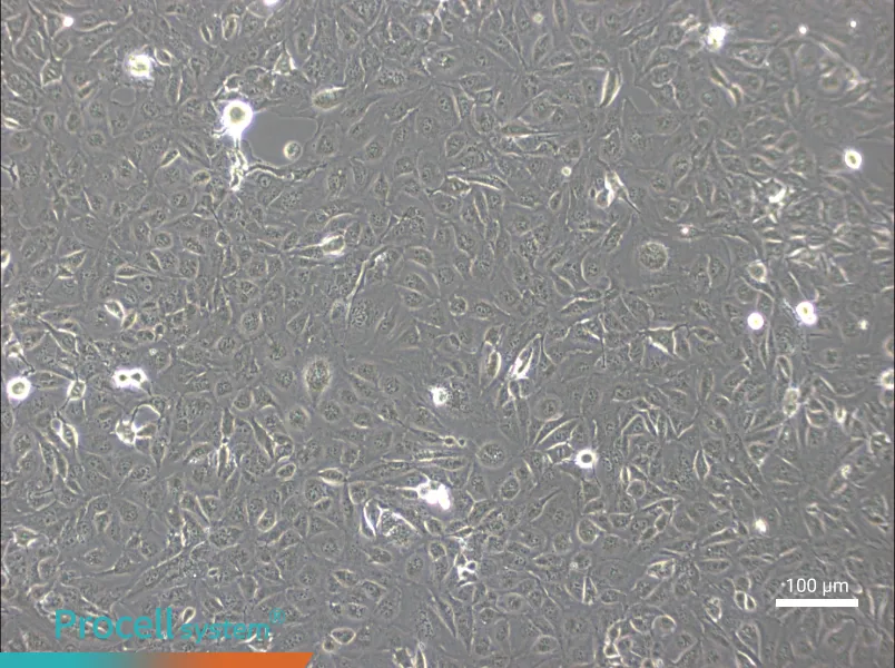 MarcusMarcus - 2