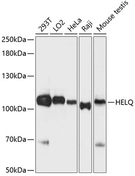 Western blot analysis of extracts of various cell lines using HEL308 Polyclonal Antibody at dilution of 1:3000.