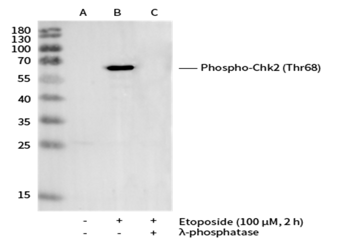 Recombinant Phospho-Chk2 (Thr68) Monoclonal Antibody