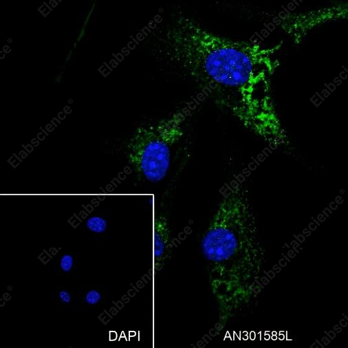 Recombinant Laminin beta 1 Monoclonal Antibody - 2