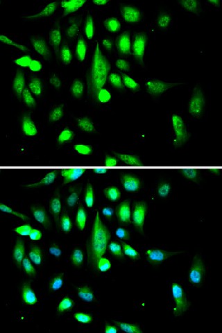 Immunofluorescence analysis of A549 cells using CDK1 Polyclonal Antibody