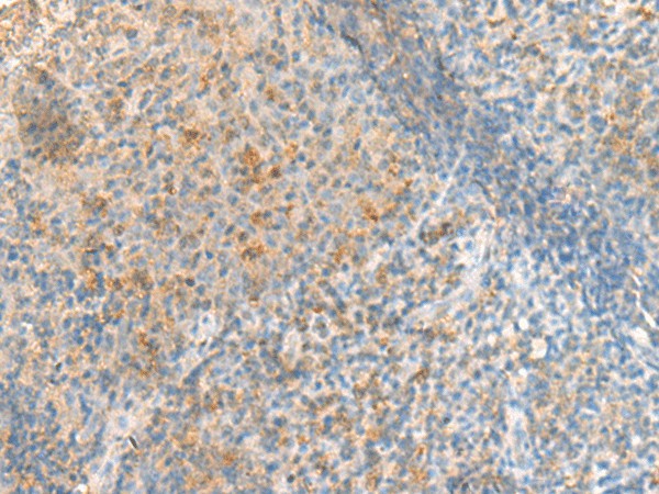 Immunohistochemistry of paraffin-embedded Human tonsil tissue  using METTL17 Polyclonal Antibody at dilution of 1:50(?200)