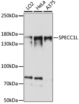 Western blot analysis of extracts of various cell lines using SPECC1L Polyclonal Antibody at 1:1000 dilution.