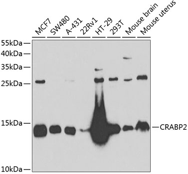 Western blot analysis of extracts of various cell lines using CRABP2 Polyclonal Antibody at 1:1000 dilution.