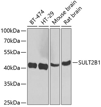 Western blot analysis of extracts of various cell lines using SULT2B1 Polyclonal Antibody at 1:1000 dilution.