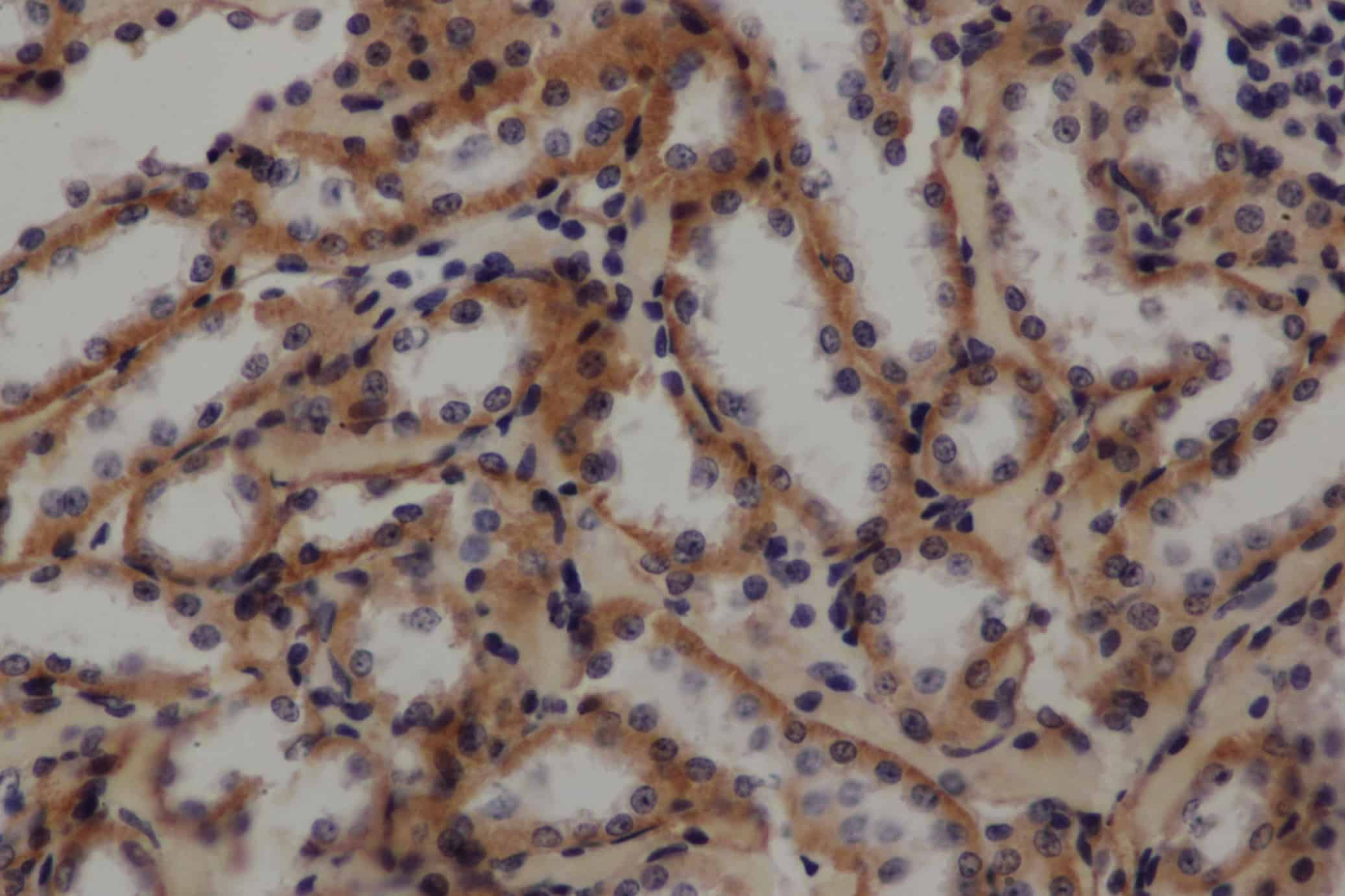 Immunohistochemistry of paraffin-embedded Rat kidney using GLUT-1 Polyclonal Antibody at dilution of 1:50