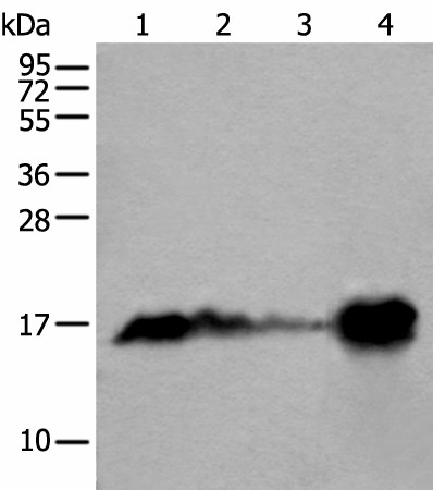 Western blot analysis of Human heart tissue Mouse heart tissue Rat heart tissue and Human muscle tissue lysates  using MB Polyclonal Antibody at dilution of 1:400