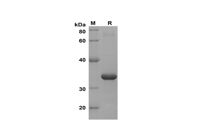 Recombinant Human XCL1/Lymphotactin Protein(Trx Tag)-产品推荐-1