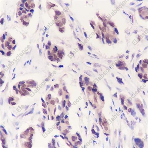 Recombinant CDK8 Monoclonal Antibody - 2