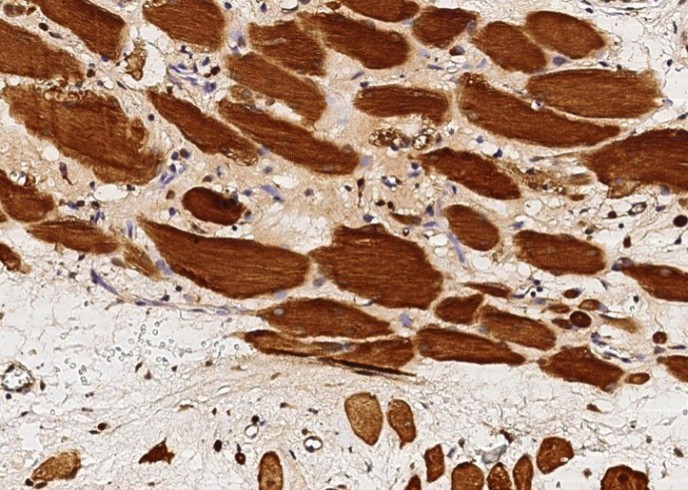Recombinant GSTM2 Monoclonal Antibody - small - 3
