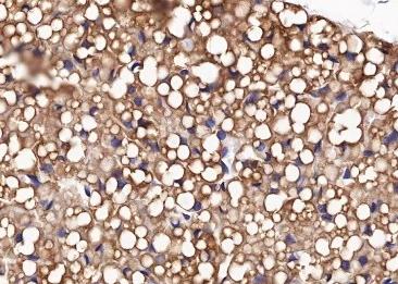 Recombinant FABP4 Monoclonal Antibody-searchlist-2