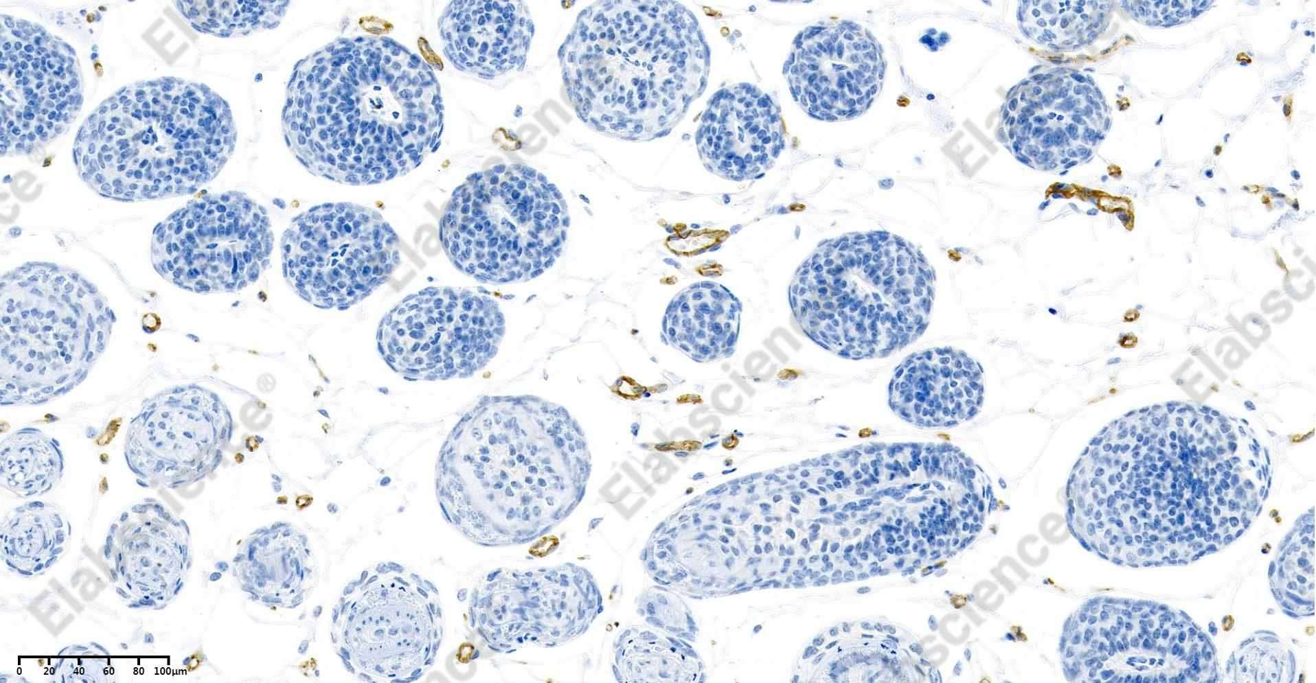 Recombinant CD31 Monoclonal Antibody - 6