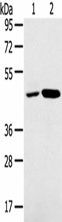 Western Blot analysis of K562 and Jurkat cell using SNX5 Polyclonal Antibody at dilution of 1:250