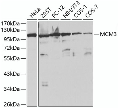 Western blot analysis of extracts of various cell lines using MCM3 Polyclonal Antibody at 1:1000 dilution.