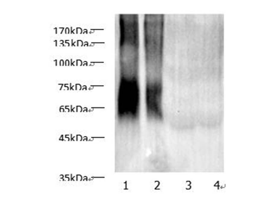 Western blot of anti-MAA Lysine Polyclonal Antibody at dilution of 1:1000.
Lane 1: MAA-HSA (10ug/lane) Lane 2: MAA- HSA (5ug/lane), Lane 3: HSA (10ug/lane),Lane 4: HSA (5ug/lane).