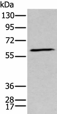 Western blot analysis of Human fetal brain tissue lysate  using GPC5 Polyclonal Antibody at dilution of 1:450