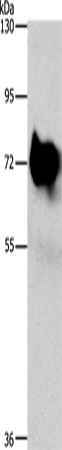 Western Blot analysis of Mouse brain tissue using SYN1 Polyclonal Antibody at dilution of 1:750