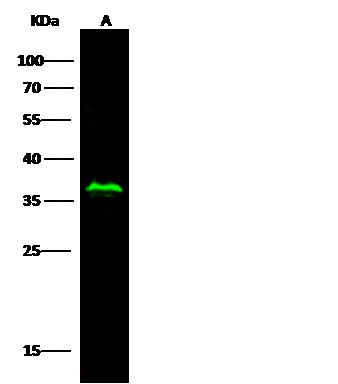 Recombinant RRM2B/P53R2 Monoclonal Antibody-searchlist-1