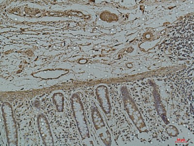 Immunohistochemistry of paraffin-embedded Human colon using Galectin 3 Monoclonal Antibody at dilution of 1:50.