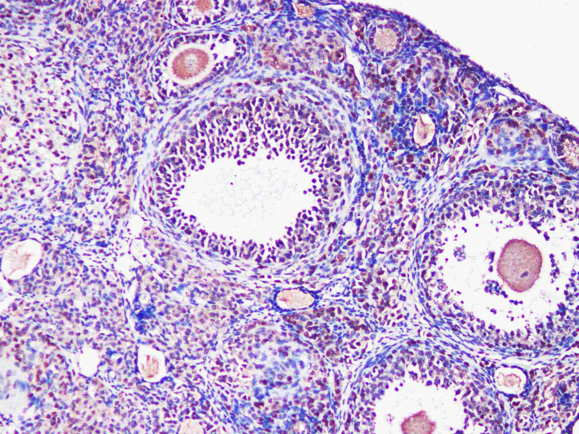 GAPDH Monoclonal Antibody - 3