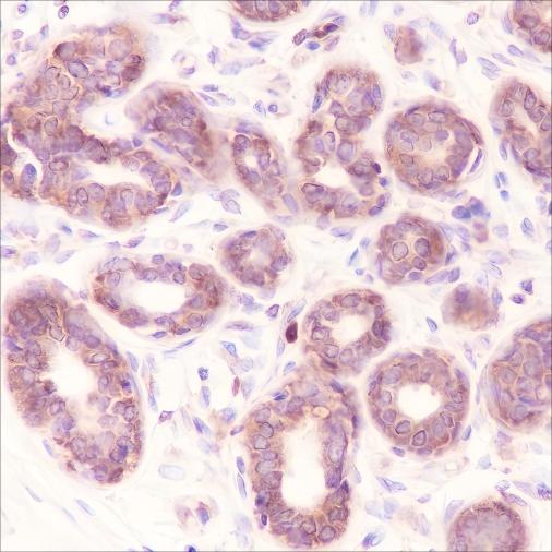 Recombinant EIF2S1 Monoclonal Antibody - small - 2