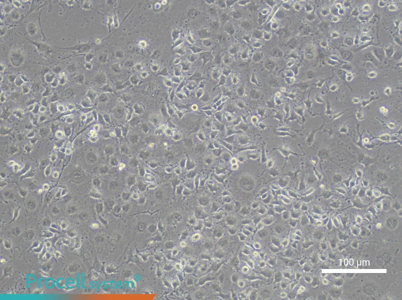 EOMAEOMA - 1