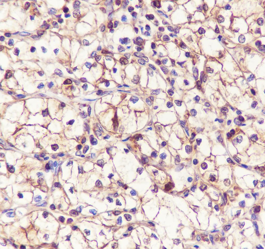 Recombinant ATP Citrate Lyase Monoclonal Antibody - small - 4