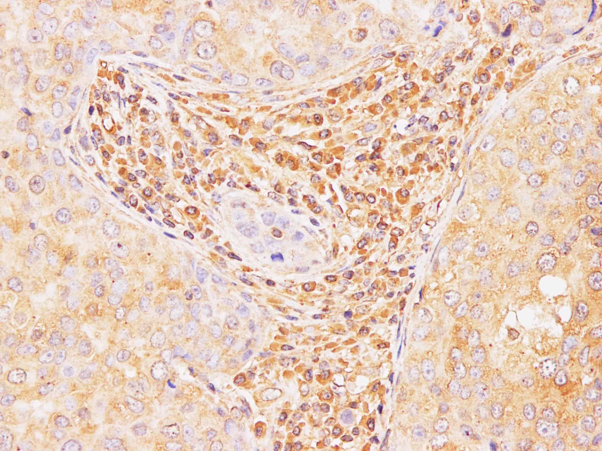 AF/LE Purified Anti-Human HLA-G Antibody[87G]-产品推荐-1