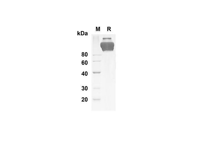 Recombinant Mouse IL-5 Protein-产品推荐-1