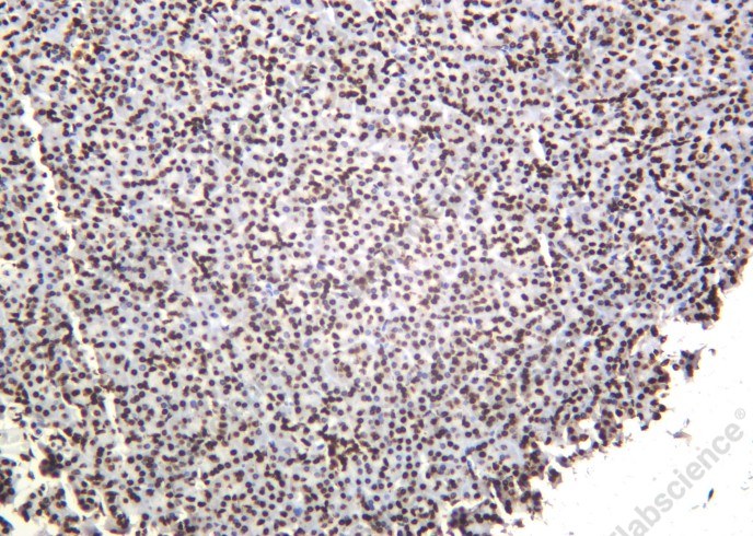 Recombinant Histone H3 (Di Methyl Lys79) Monoclonal Antibody - 2