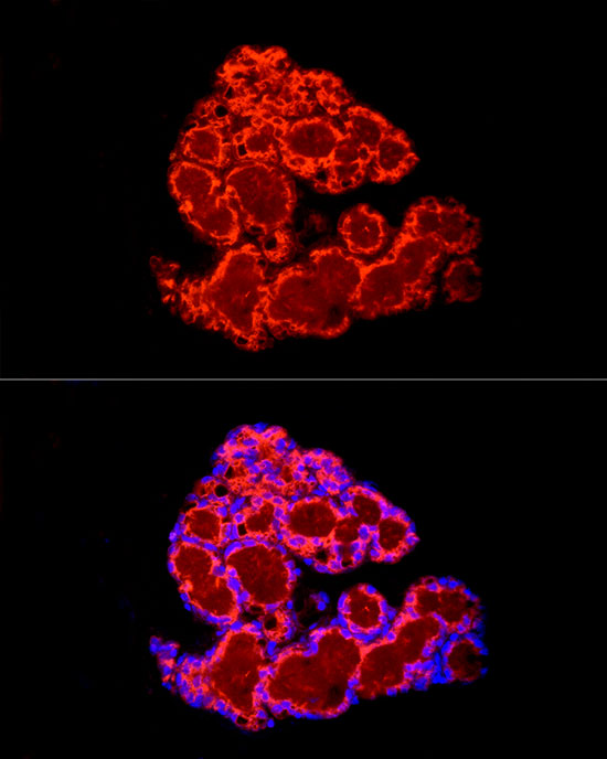 Immunofluorescence analysis of Rat adipose cells using FABP4 Polyclonal Antibody at dilution of 1:150 (40x lens). Blue: DAPI for nuclear staining.