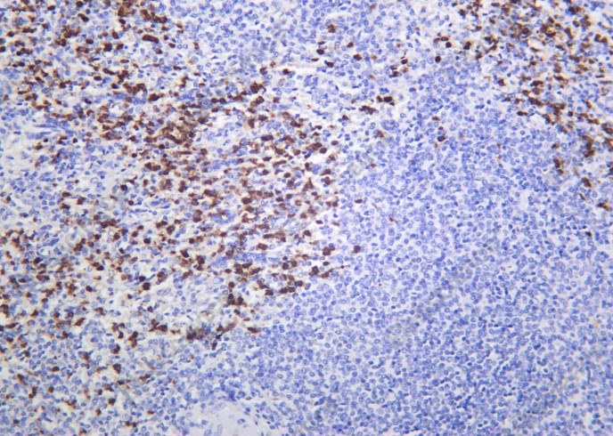 Recombinant BIRC2 Monoclonal Antibody - 2