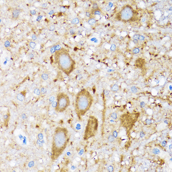 Immunohistochemistry of paraffin-embedded Mouse spinal cord using HSPH1 Polyclonal Antibody at dilution of 1:100 (40x lens).