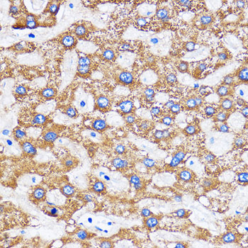 Immunohistochemistry of paraffin-embedded Human liver using MITD1 Polyclonal Antibody at dilution of 1:100 (40x lens).Perform microwave antigen retrieval with 10 mM PBS buffer pH 7.2 before commencing with IHC staining protocol.