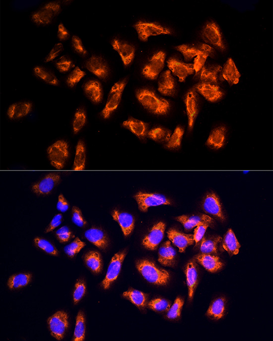 Immunofluorescence analysis of U2OS cells using NPHP4 Polyclonal Antibody at dilution of 100 (40x lens). Blue: DAPI for nuclear staining.